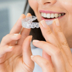 Top 5 Benefits of Choosing Invisalign in San Bernardino